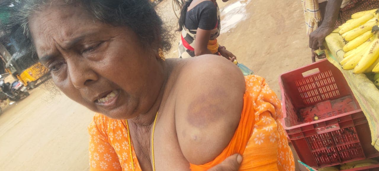 దళిత మహిళపై అమానుషంగా దాడి